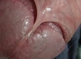 virgin penis very commodious seen increased by turn skin outside be required of of penis head