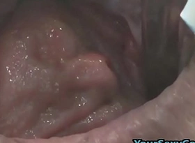 Extreme anal and pussy prolapse after bizarre dp